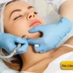 Σεμινάριο Δερμοαπόξεσης Microdermabrasion | Προηγμένη μέθοδος Απολέπισης