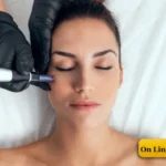 Σεμινάριο Μεσοθεραπείας Microneedling  | Dermapen & Dermaroller